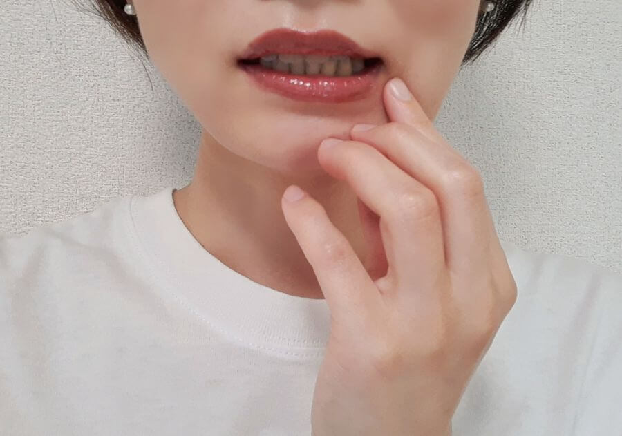 歯石取りを自分で行うメリットとデメリット