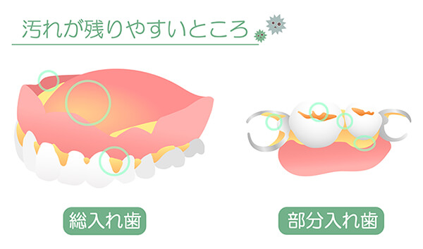 入れ歯のお手入れ方法