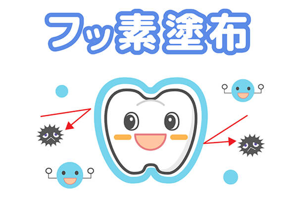 フッ素塗布