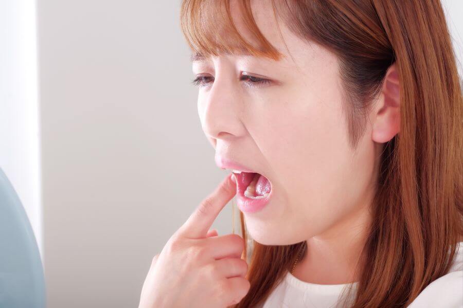 口内炎が治らない？まず知っておきたい基礎知識