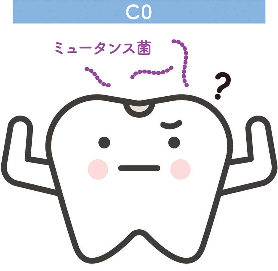 CO（むし歯の前兆）